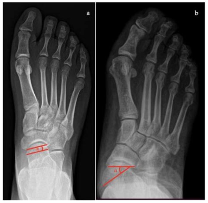 Barry Gibb's Height: Uncovering The Mystery