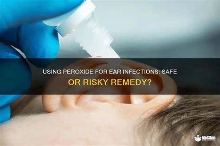 Can I put peroxide in my ear to unclog it?