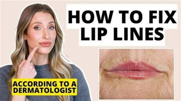 Does Cinnamon help lip lines?
