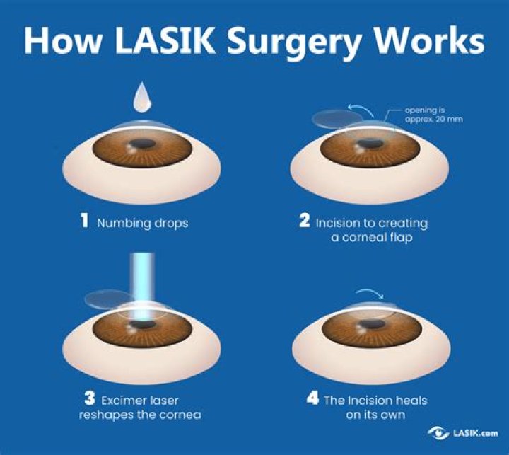 Does PRK last longer than LASIK?