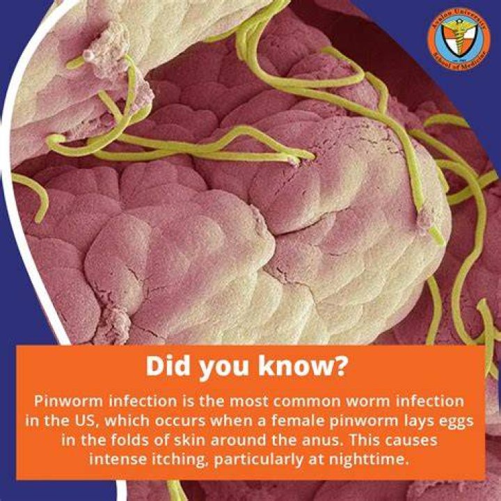 Is it common for adults to get pinworms?