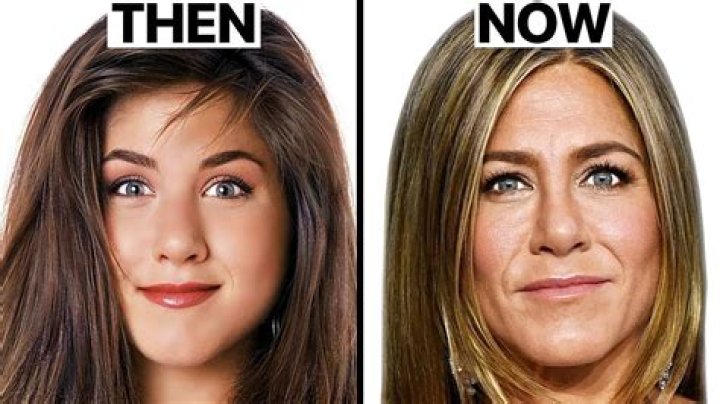 Jennifer Aniston After Plastic Surgery