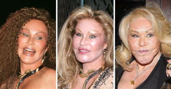 Jocelyn Wildenstein Young Photos