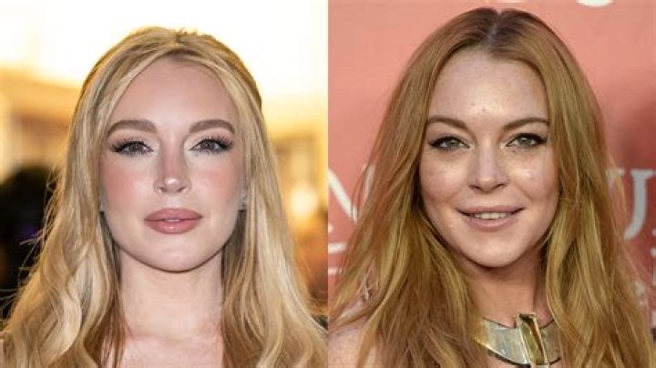 Lindsay Lohan's Plastic Surgery: Before And After Comparisons