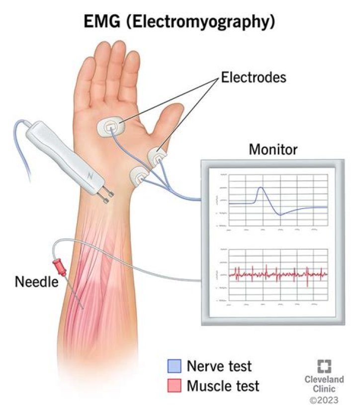 What are the disadvantages of using an EMG?