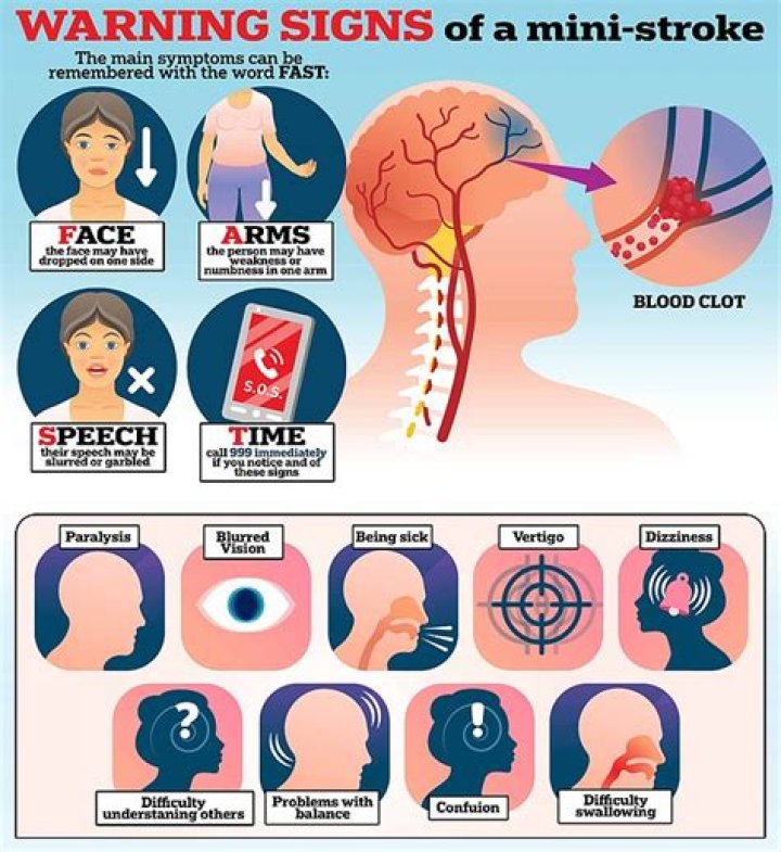 What do I do if I had a mini stroke?