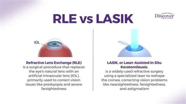 What is the difference between LASIK and Lasik Plus?