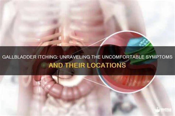 Where do you itch with gallbladder problems?